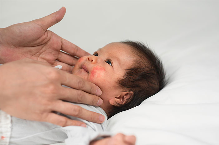 Wie man Hautinfektionen bei Babys überwindet