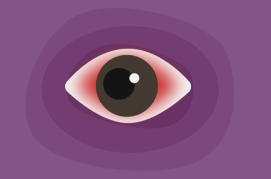 הנה איך דלקת הלחמית גורמת לעיניים אדומות