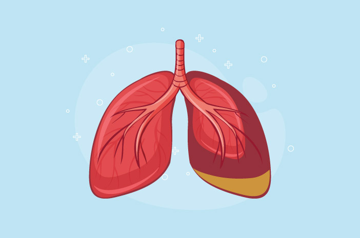 원인에 따른 3가지 종류의 폐렴약