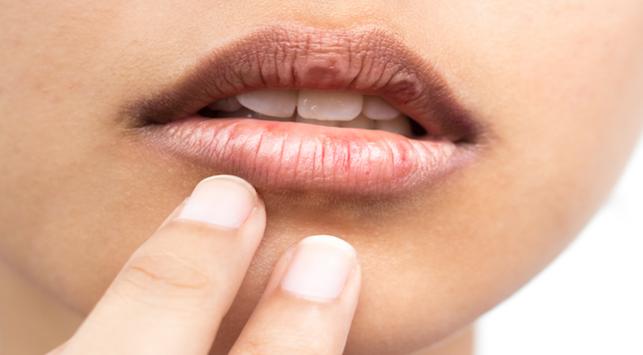 립밤 없이 건조한 입술을 극복하는 6가지 쉬운 방법