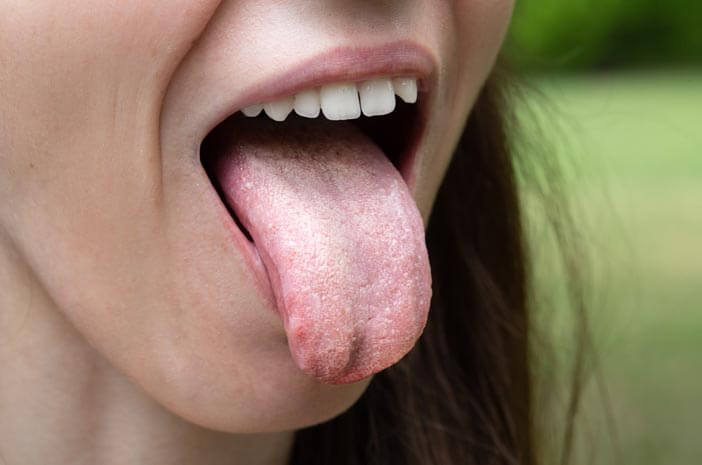 건강에 해로운 친밀한 관계가 혀암을 유발할 수 있습니까?