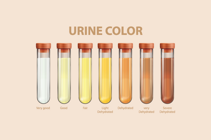 Culoarea urinei determină cu adevărat sănătatea rinichilor?